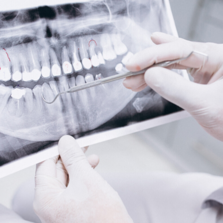 Radiografia Odontológica