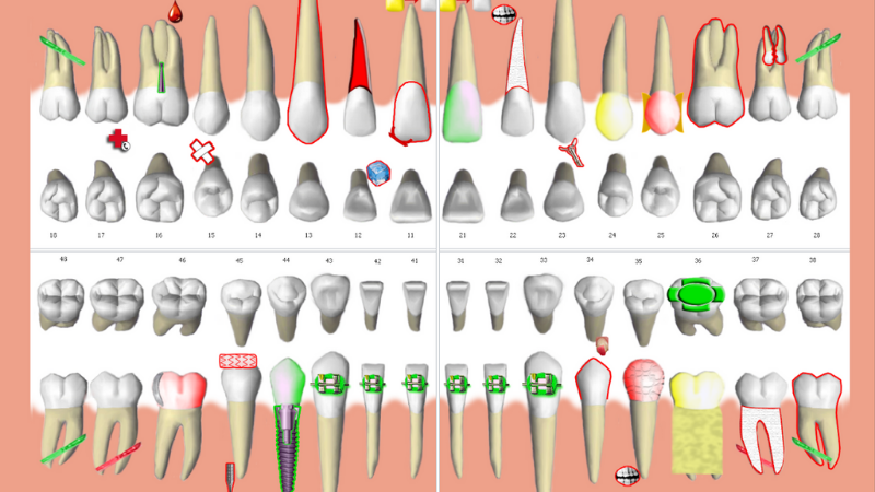 Odontograma Dental 3900